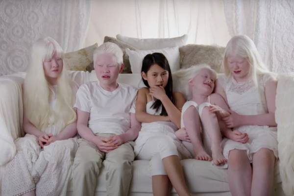 Exclusive: TLC slates Thinkfactory Media-produced special “Born with Albinism”